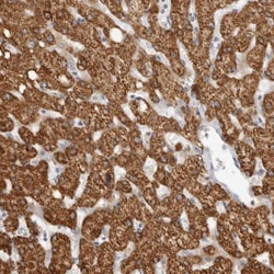 HMGCS2 Antibody, Novus Biologicals 0.1mL; Unlabeled:Antibodies, Polyclonal