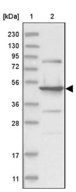 HMGCS2 Antibody, Novus Biologicals 25 &mu;L, Unlabeled:Antibodies, Polyclonal