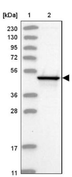 HMGCS2 Antibody, Novus Biologicals 0.1mL; Unlabeled:Antibodies, Polyclonal