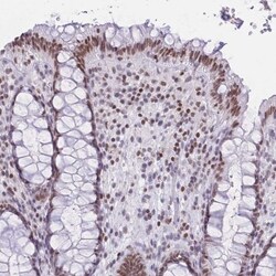 HMGN1/HMG14 Antibody, Novus Biologicals 0.1mL; Unlabeled:Antibodies, Polyclonal
