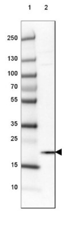 HMGN1/HMG14 Antibody, Novus Biologicals 0.1mL; Unlabeled:Antibodies, Polyclonal
