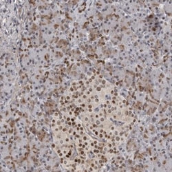 HMGN3/TRIP7 Antibody, Novus Biologicals 0.1mL; Unlabeled:Antibodies, Polyclonal