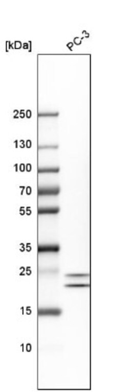HN1 Antibody, Novus Biologicals 0.1mL; Unlabeled:Antibodies, Polyclonal