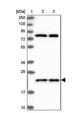 HN1L Antibody, Novus Biologicals 25 &mu;L | Buy Online | Novus Biologicals | Fisher Scientific
