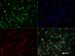 HNF-3 alpha/FoxA1 Antibody (3B11NB) - BSA Free, Novus Biologicals:Antibodies:Primary