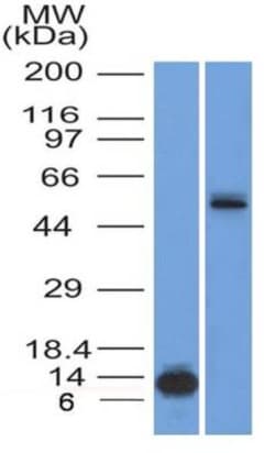 HNF-3 alpha/FoxA1 Antibody (3B11NB) - BSA Free, Novus Biologicals:Antibodies:Primary