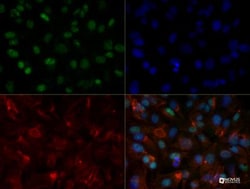 HNF-3 alpha/FoxA1 Antibody (3B3NB) - BSA Free, Novus Biologicals 0.025 mg | Buy Online | Novus Biologicals | Fisher Scientific