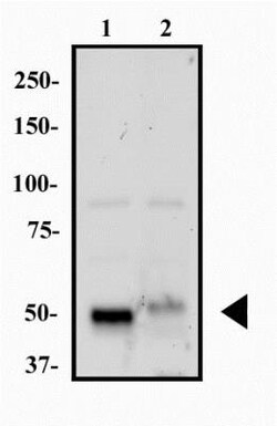 HNF-3 alpha/FoxA1 Antibody (3B3NB) - BSA Free, Novus Biologicals 0.025 mg | Buy Online | Novus Biologicals | Fisher Scientific