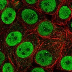 HNF-3 alpha/FoxA1 Antibody, Novus Biologicals 0.1mL; Unlabeled:Antibodies,