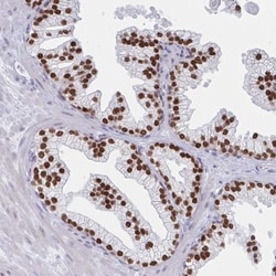 HNF-3 alpha/FoxA1 Antibody, Novus Biologicals 0.1mL; Unlabeled:Antibodies,