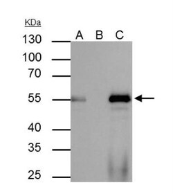HNF-3 alpha/FoxA1 Antibody, Novus Biologicals 0.1mg; Unlabeled:Antibodies,