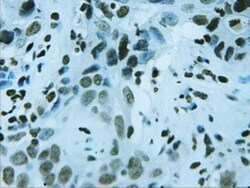 HNF-3 beta/FoxA2 Antibody (OTI3C10), Novus Biologicals 0.1mL; Unlabeled:Antibodies,