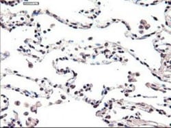 HNF-3 beta/FoxA2 Antibody (OTI3C10), Novus Biologicals 0.1mL; Unlabeled:Antibodies,