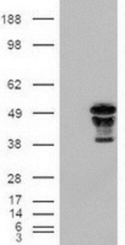 HNF-3 beta/FoxA2 Antibody (OTI3C10), Novus Biologicals 0.1mL; Unlabeled:Antibodies,