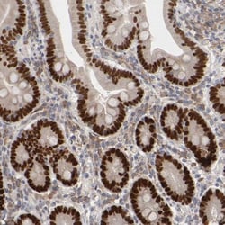 HNF-4 alpha/NR2A1 Antibody, Novus Biologicals 25 &mu;L; Unlabeled:Antibodies,