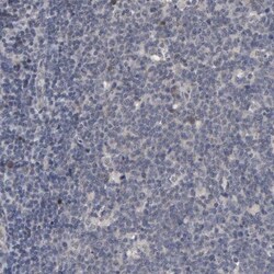 HNF-4 alpha/NR2A1 Antibody, Novus Biologicals 25 &mu;L; Unlabeled:Antibodies,