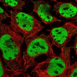 HNF1 Antibody, Novus Biologicals 0.1mL; Unlabeled:Antibodies, Polyclonal