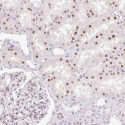 HNF1 Antibody, Novus Biologicals 0.1mL; Unlabeled:Antibodies, Polyclonal