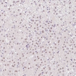 HNF1 Antibody, Novus Biologicals 0.1mL; Unlabeled:Antibodies, Polyclonal