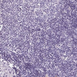 HNF1 Antibody, Novus Biologicals 0.1mL; Unlabeled:Antibodies, Polyclonal