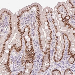 HNF1 Antibody, Novus Biologicals 0.1mL; Unlabeled:Antibodies, Polyclonal