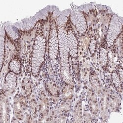 HNRNPUL1 Antibody, Novus Biologicals 0.1mL; Unlabeled:Antibodies, Polyclonal