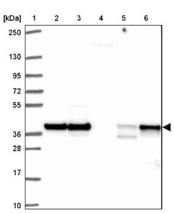 HNRPDL Antibody, Novus Biologicals:Antibodies:Primary Antibodies