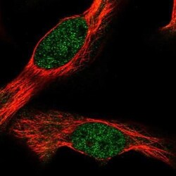 HNRPGT Antibody, Novus Biologicals 25 &mu;L, Unconjugated:Antibodies, Polyclonal