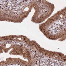 HNRPLL Antibody, Novus Biologicals 0.1mL; Unlabeled:Antibodies, Polyclonal