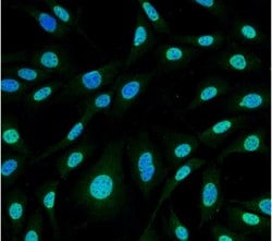 HO-1/HMOX1/HSP32 Antibody (6B8-2F2), Novus Biologicals:Antibodies:Primary