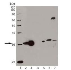 HO-1/HMOX1/HSP32 Antibody (HO-1-1), Novus Biologicals 0.2mg; Unlabeled:Antibodies,