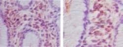 HOIP/RNF31 Antibody, Novus Biologicals 0.025mg; Unlabeled:Antibodies, Polyclonal