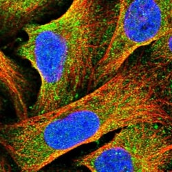 HOMER1 Antibody, Novus Biologicals 0.1mL; Unlabeled:Antibodies, Polyclonal