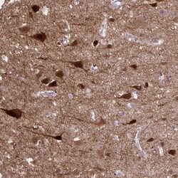 HOMER1 Antibody, Novus Biologicals 25 &mu;L, Unlabeled:Antibodies, Polyclonal