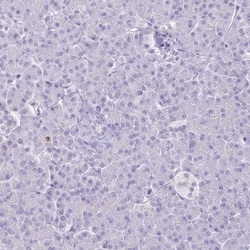 HOMER1 Antibody, Novus Biologicals 25 &mu;L, Unlabeled:Antibodies, Polyclonal
