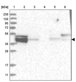 HOMER1 Antibody, Novus Biologicals 0.1mL; Unlabeled:Antibodies, Polyclonal