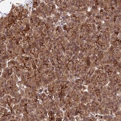 HOMER2 Antibody, Novus Biologicals 0.1mL; Unlabeled:Antibodies, Polyclonal