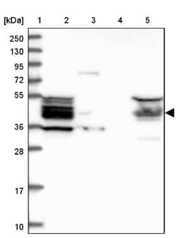 HOMER2 Antibody, Novus Biologicals 0.1mL; Unlabeled:Antibodies, Polyclonal