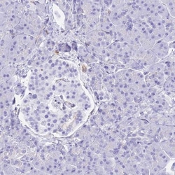 HOMER3 Antibody, Novus Biologicals:Antibodies:Primary Antibodies