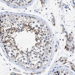 HOOK1 Antibody, Novus Biologicals 0.1mL; Unlabeled:Antibodies, Polyclonal