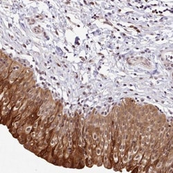 HOXB7 Antibody, Novus Biologicals:Antibodies:Primary Antibodies