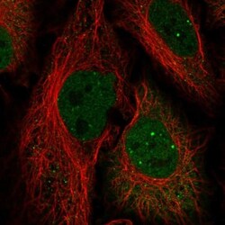 HOXC10 Antibody, Novus Biologicals 0.1mL; Unlabeled:Antibodies, Polyclonal