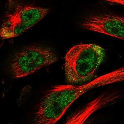 HOXC11 Antibody, Novus Biologicals:Antibodies:Primary Antibodies