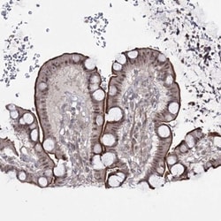 HOXC11 Antibody, Novus Biologicals:Antibodies:Primary Antibodies