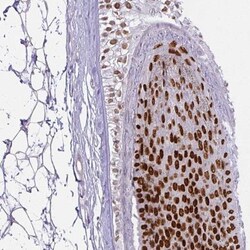 HOXC13 Antibody, Novus Biologicals:Antibodies:Primary Antibodies