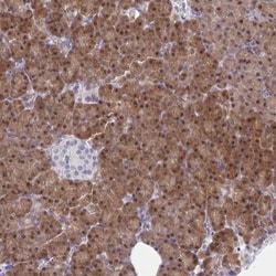HOXD12 Antibody, Novus Biologicals 25 &mu;L | Buy Online | Novus Biologicals | Fisher Scientific