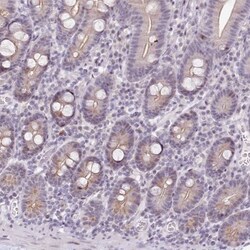 HPD Antibody, Novus Biologicals 0.1mL; Unlabeled:Antibodies, Polyclonal