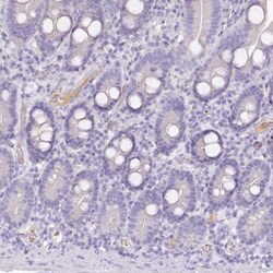 HPD Antibody, Novus Biologicals:Antibodies:Primary Antibodies