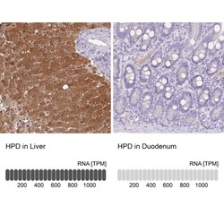 HPD Antibody, Novus Biologicals:Antibodies:Primary Antibodies
