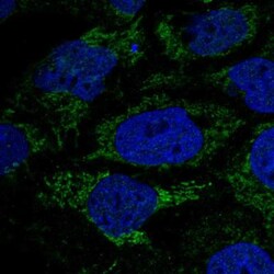 HPDL Antibody, Novus Biologicals 0.1mL; Unlabeled:Antibodies, Polyclonal